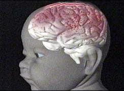 Não của trẻ 3 tháng tuổi cũng phức tạp như não người lớn?